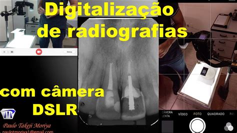 Linear Slot De Digitalizacao De Radiografias